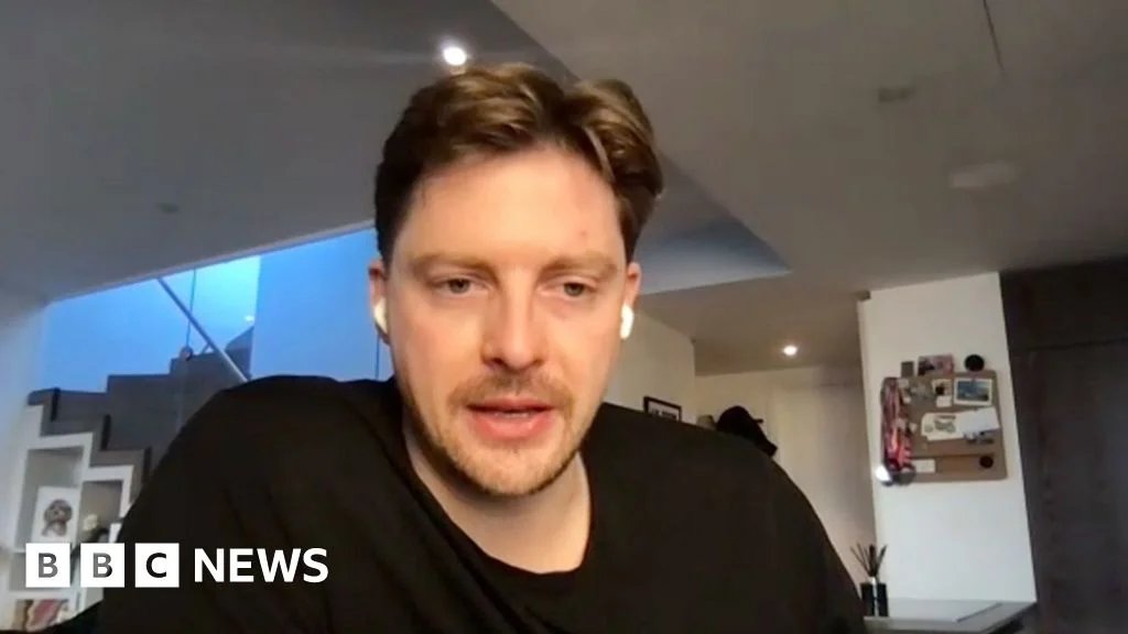 Love Islands Dr Alex Georges ADHD Diagnosis Completely Changed His Life - صورة مميزة صورة مميزة: Love Islands Dr Alex Georges ADHD Diagnosis Completely Changed His Life